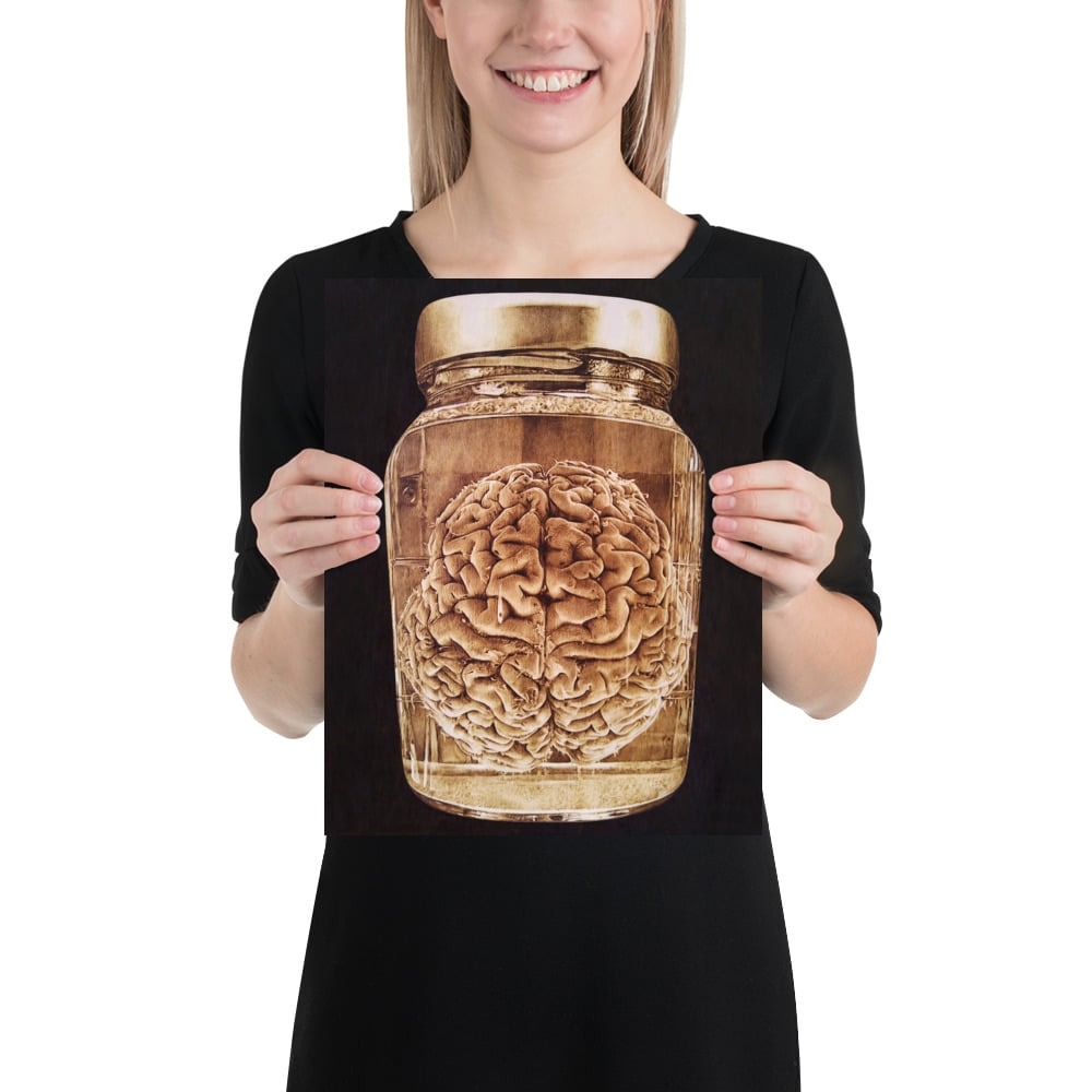 Photo Print: Brain Wet Specimen (black)