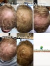 Root Juice Scalp Fertilizer 2oz