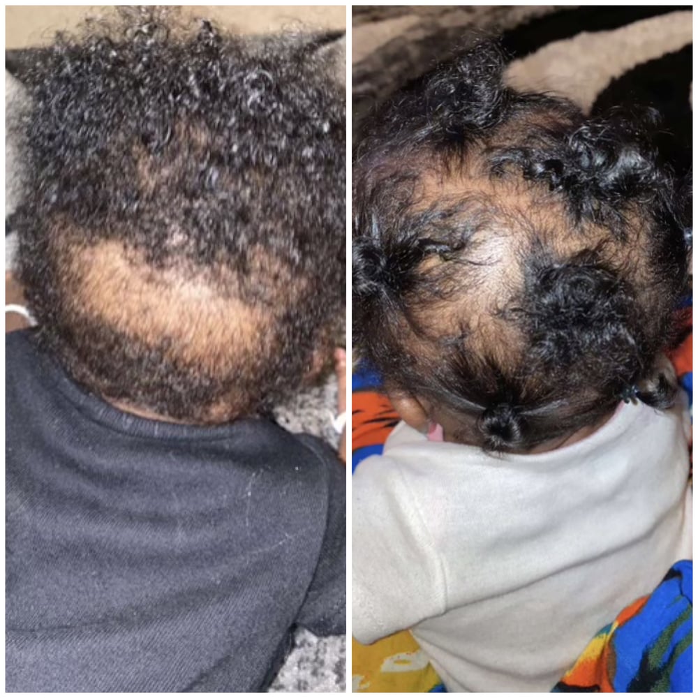 Image of Sabr’s Small hair growth