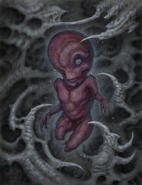 Image 2 of Fetus A
