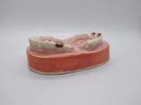 Image 2 of Teeth Dish