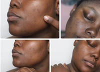 Image 2 of “DIAMONDS” CORRECTING CREAM w/DEOXYARBUTIN, ALPHA ARBUTIN, KOJIC DIPALMITATE (Extra Strength) 