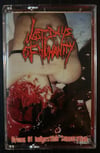 Last Days of Humanity: Hymns of Indigestible Suppuration- tape