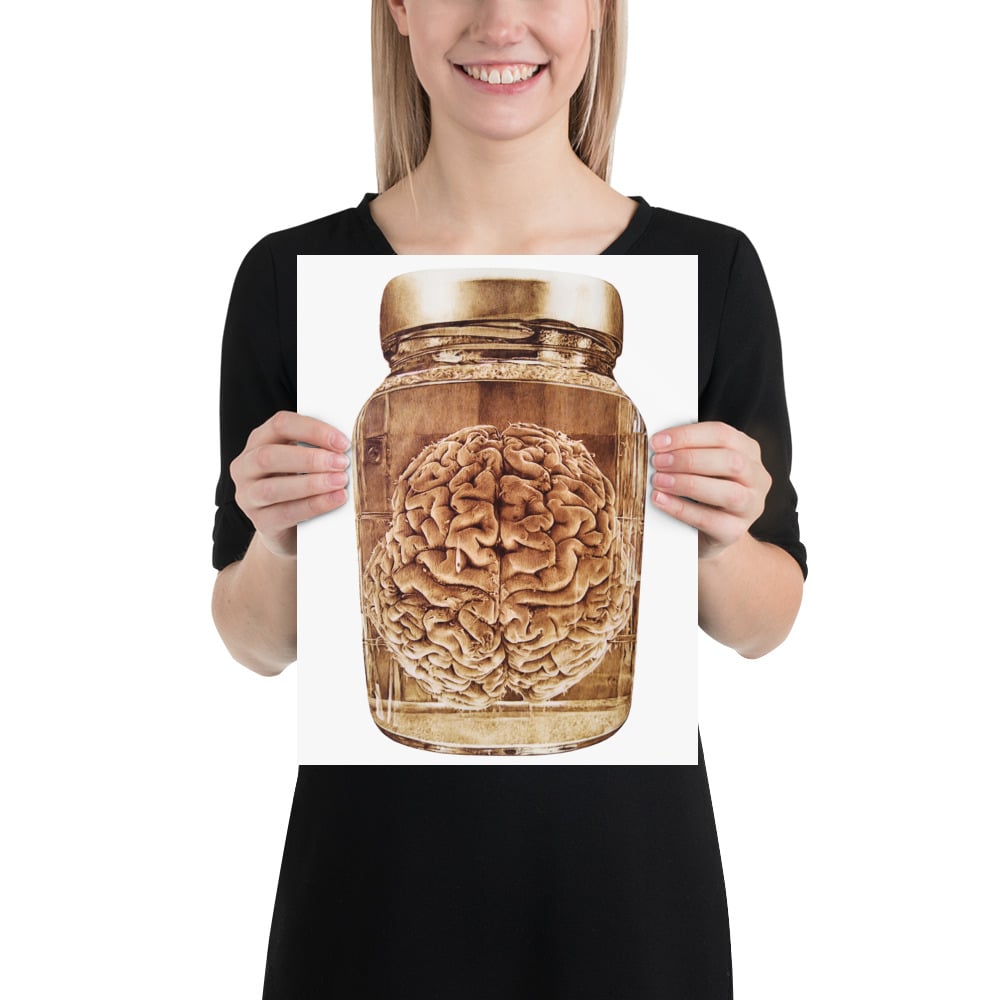 Photo Print: Brain Wet Specimen (white)