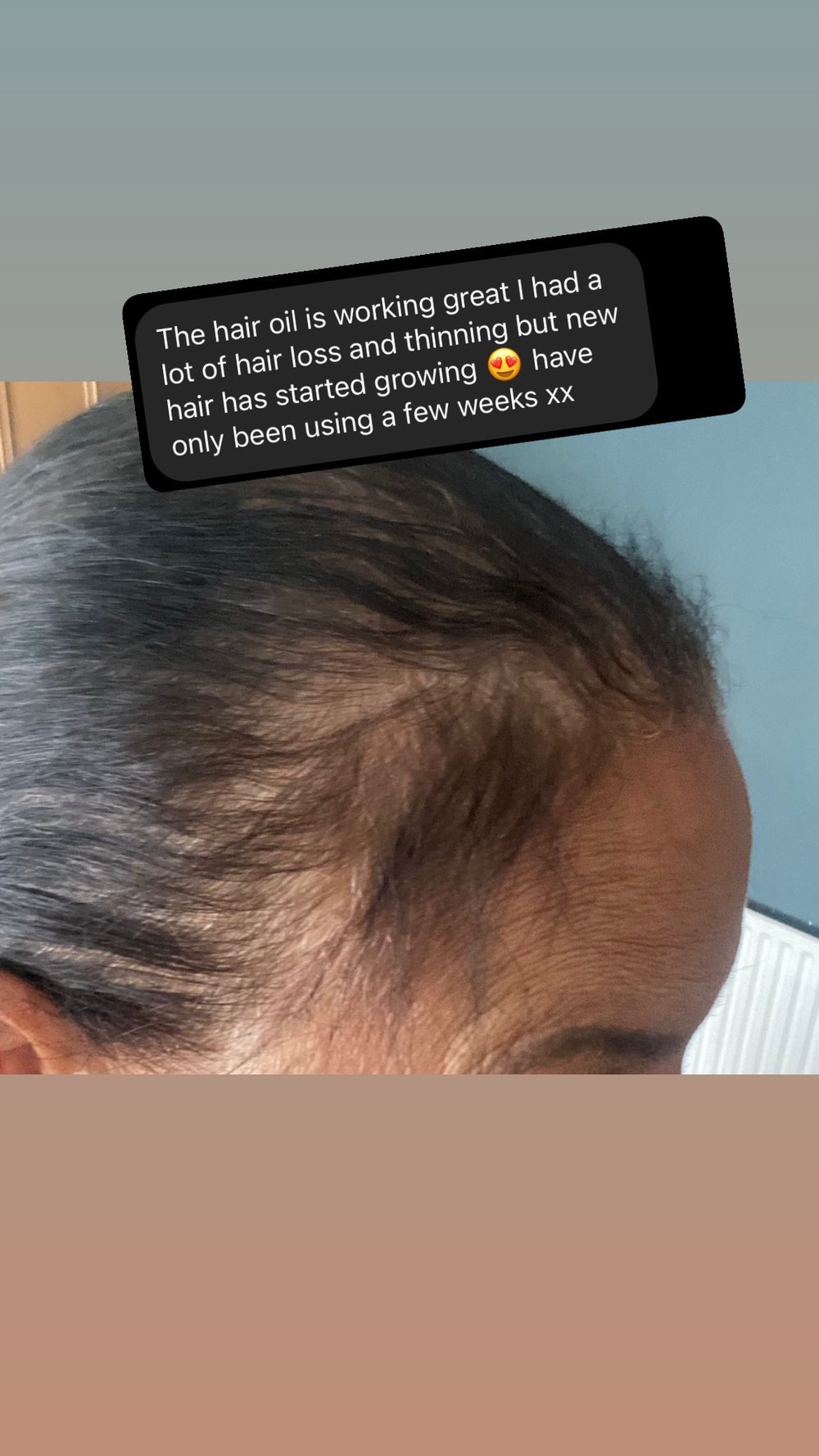 Image of Hair Growth Oil