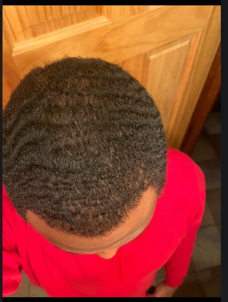 Image of Hair Growth Club Subscription 🎀 