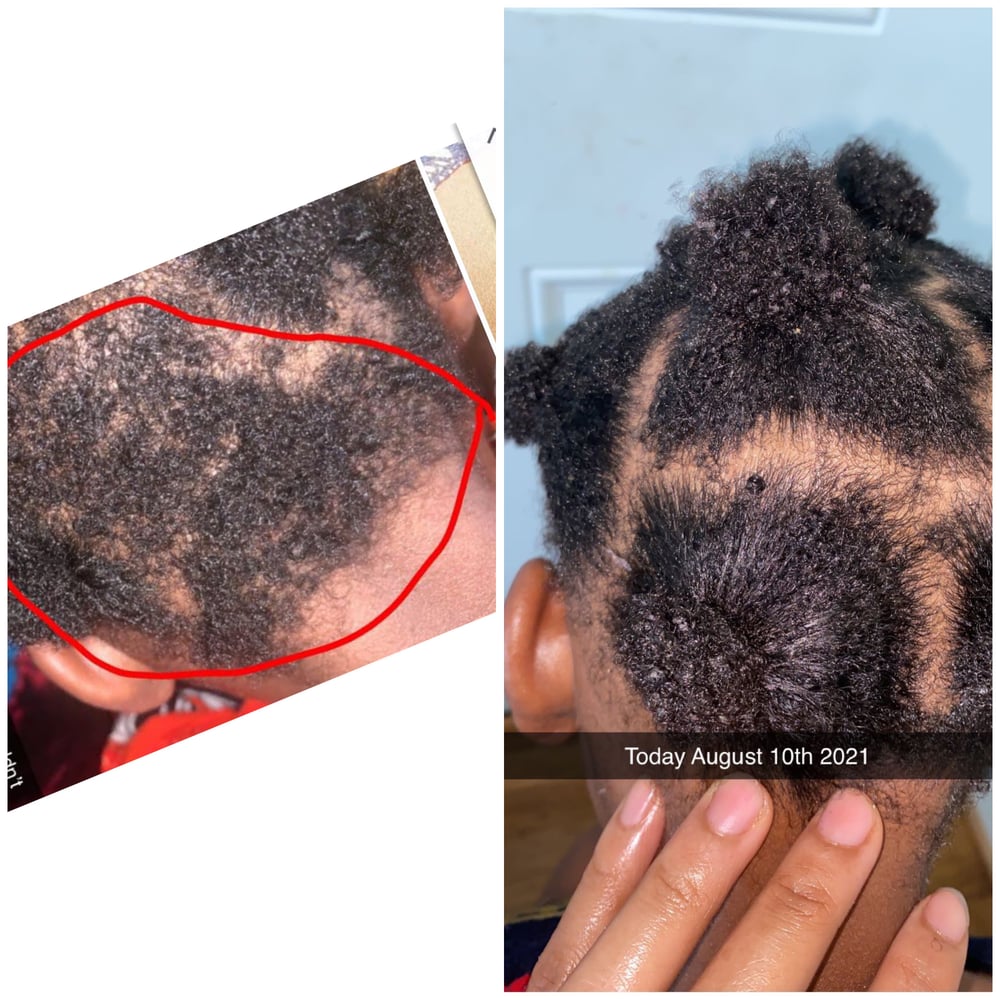 Image of Sabr’s Small hair growth