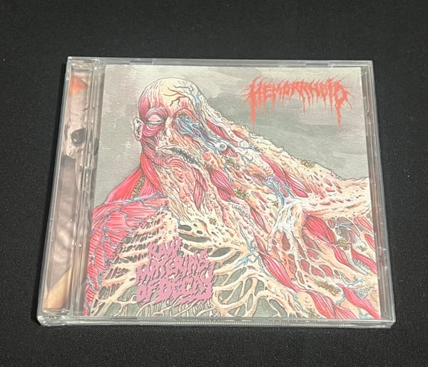 Image of Hemorrhoid- Raw Materials of Decay