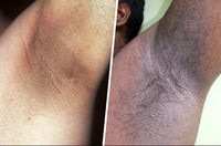 Image 10 of ROSEMARY SKIN BRIGHTENING INNER THIGH CREAM, “SLATE” SKIN BRIGHTENING EXFOLIATING SUGAR SCRUB