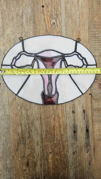 Image 5 of Anatomical uterus 