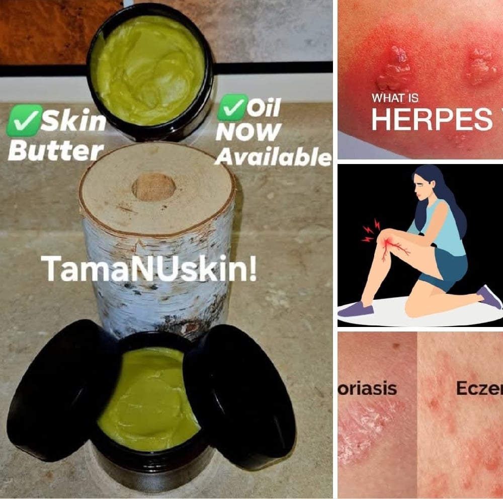 TamaNUskin! Luxurious Moisturizing Exotic Tamanu Nut Seed Body Butter. Eczema. Renews Skin Cells.