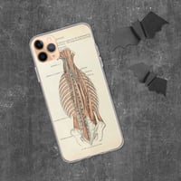 Image 2 of Antique Bookpage Detailed Anatomical Illustration Human Torso Clear Case for iPhone®