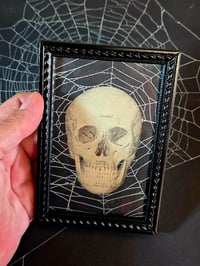 Image 2 of ANTIQUE ANATOMICAL COLLECTION - Preserved web  F