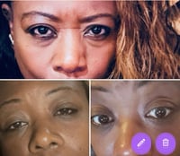 Image 2 of Bags Be Gone Eye Kit 