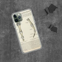 Image 4 of Antique Bookpage Detailed Anatomical Illustration Finger Bones Clear Case for iPhone®