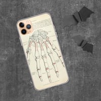 Image 2 of Antique Bookpage Detailed Anatomical Illustration Human Hand Clear Case for iPhone®