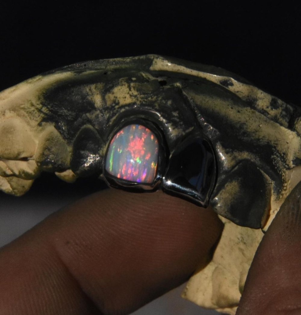 Sterling Silver And Opal Grills.