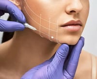 FACELIFT 