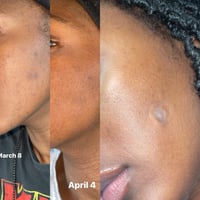 Image 3 of Kojie Skin Cleanser 