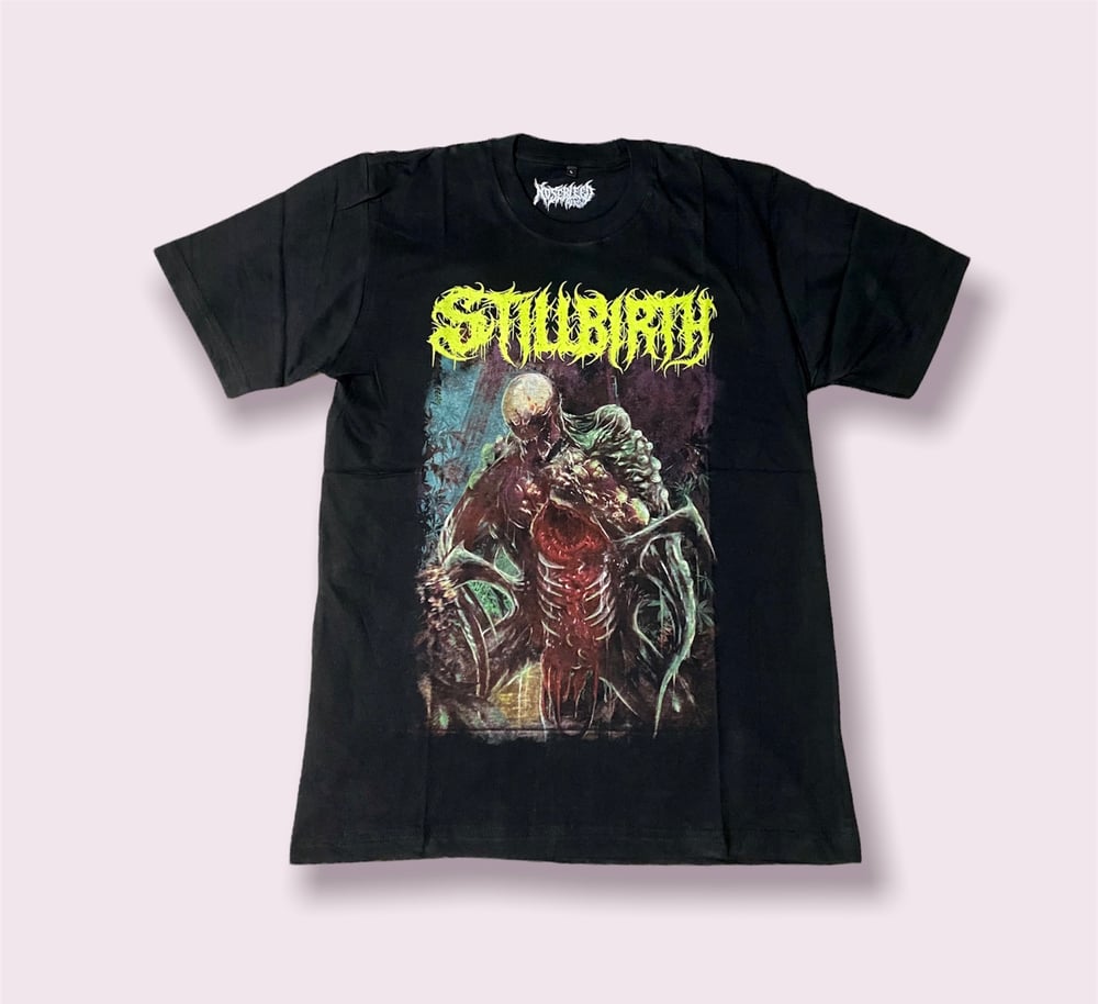 Stillbirth 