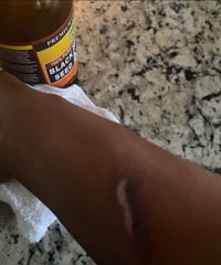 Image 4 of BLACK SEED OIL