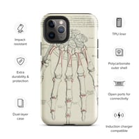 Image 3 of Antique Bookpage Detailed Anatomical Illustration Human Hand Tough Case for iPhone®