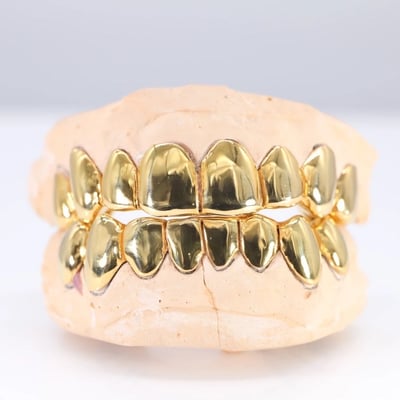 Image of 14K Gold Grillz