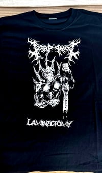 Laminectomy Short Sleeve 