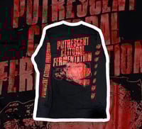 Image 5 of Vulvectomy (SS/LS)