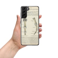 Image 9 of Antique Anatomical Drawing Bones Of The Finger Clear Case for Samsung®