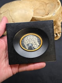 Image 4 of ANTIQUE ANATOMICAL COLLECTION - Preserved web-HEAD