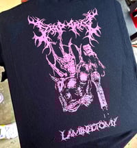 Image 1 of Black Laminectomy Tshirt 