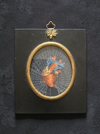 Image 1 of ANTIQUE ANATOMICAL COLLECTION - Preserved web  - 1