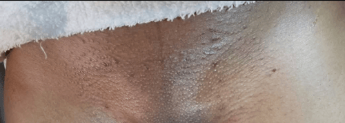 Image of Galentine Brazilian Wax  ( Pair)