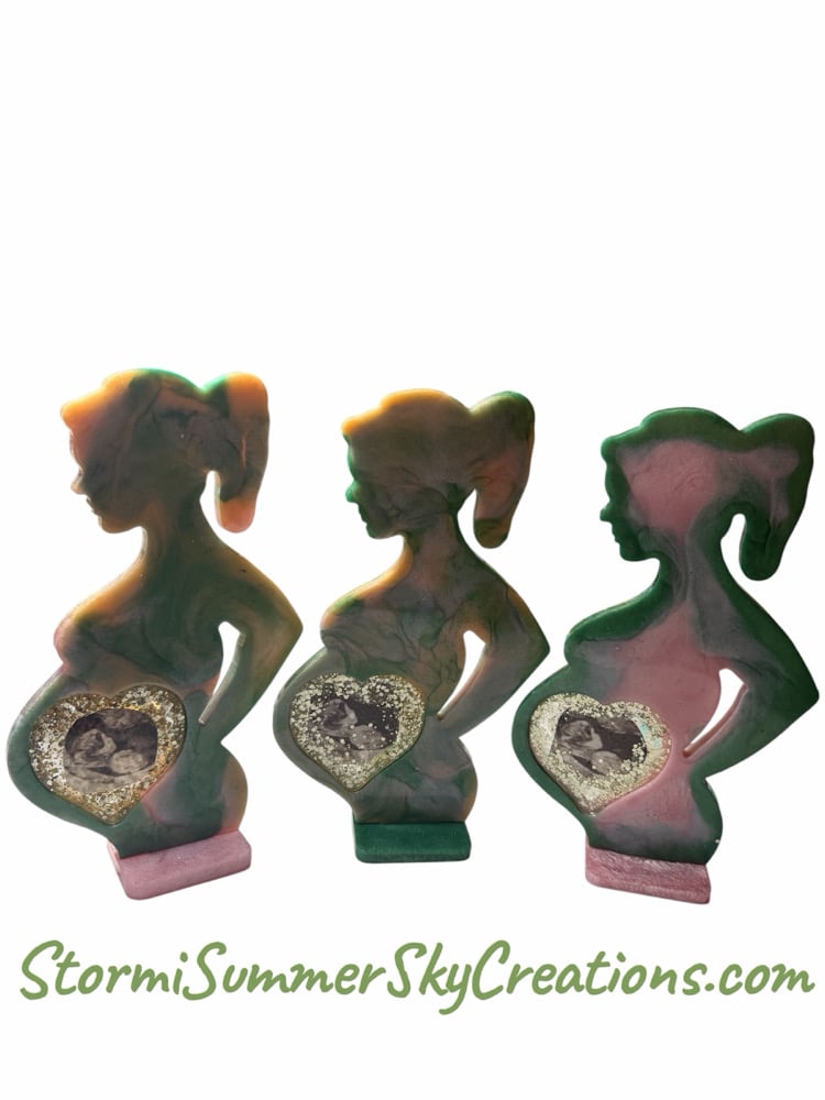 Image of Ultrasound Mothers belly