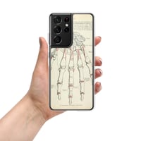 Image 7 of Antique Anatomical Drawing Bones Of The Hand Clear Case for Samsung®