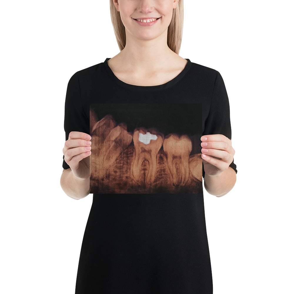 Photo Print: Dental X-ray