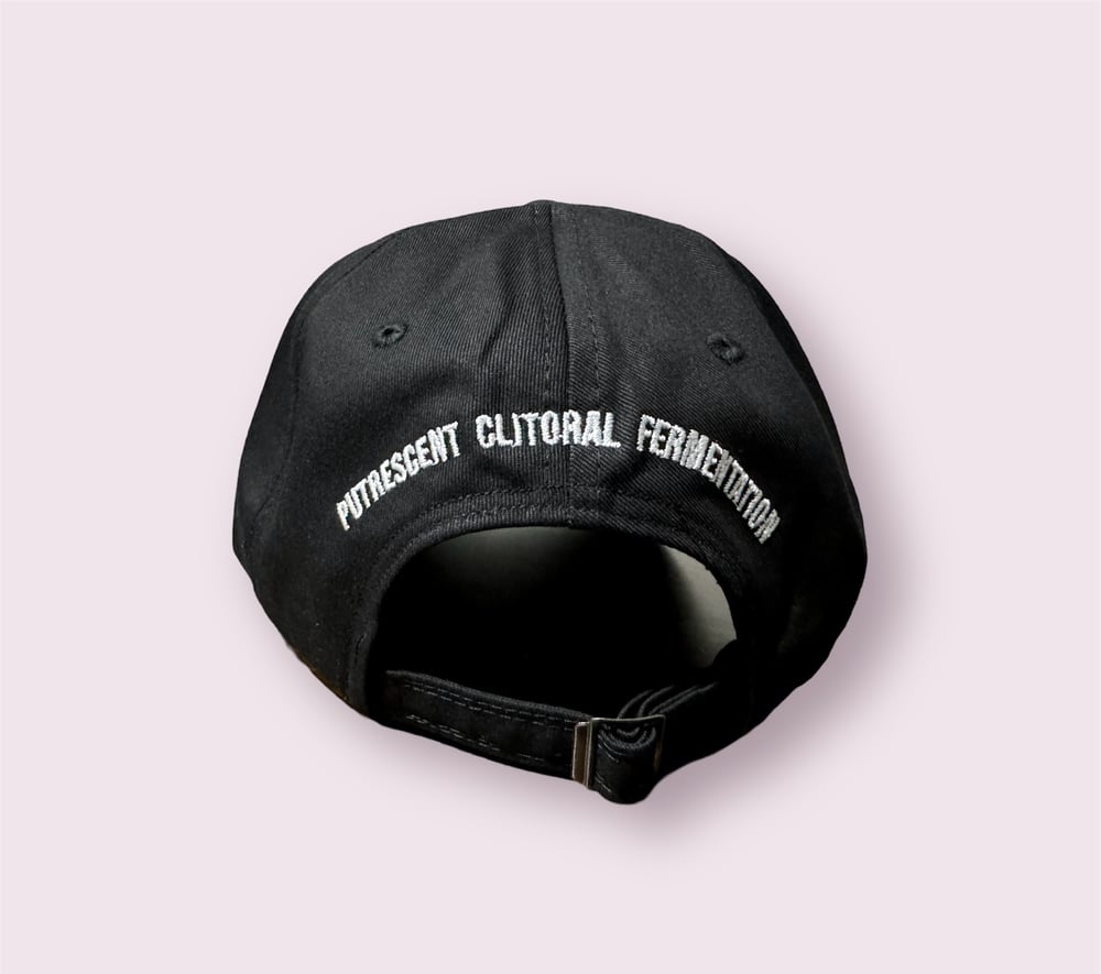 Vulvectomy - Dat Hat