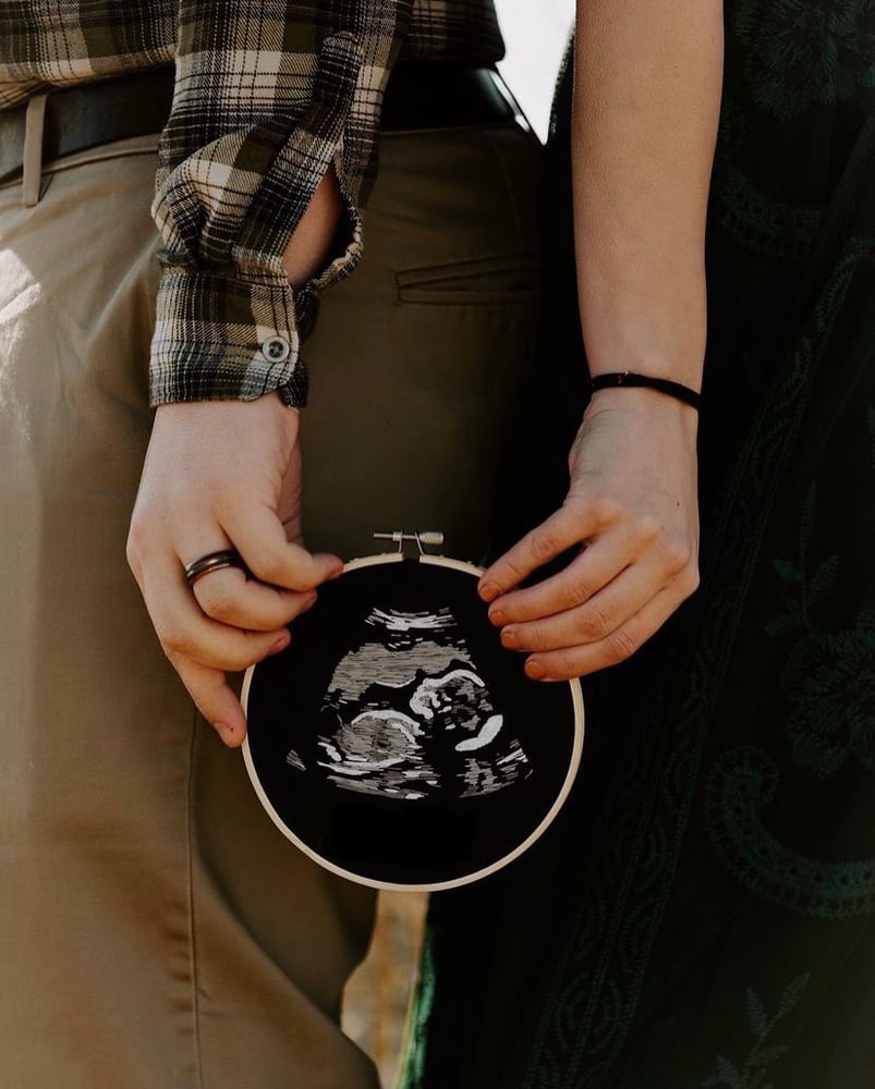 Image of Ultrasound 5 inch 