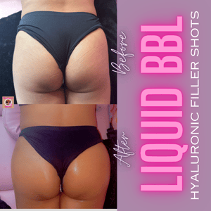 Image of LIQUID BBL TRAINING MANUAL