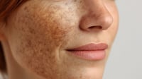 Image 8 of "DERMA" COMFREY & ARNICA HEALING SALVE 