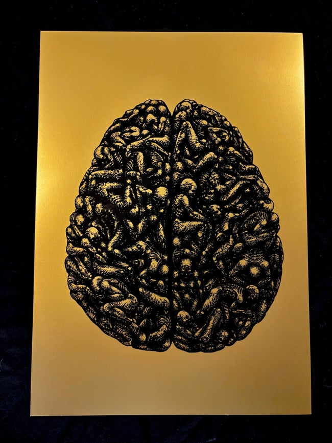 Brain Death Gold