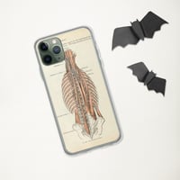 Image 5 of Antique Bookpage Detailed Anatomical Illustration Human Torso Clear Case for iPhone®