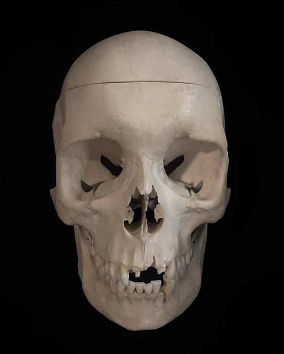 Image of Real Human Skull