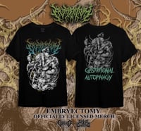 Image 1 of Embryectomy - Version 2