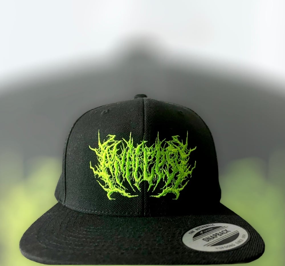 Analepsy (Snapback)