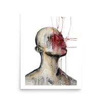 The pain is growing (print)