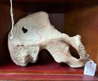 Antique Medical Human Hip Bone - Pre-1947 Real Human Skeleton Specimen  