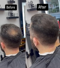 Image 4 of Hair Fiber Kit 