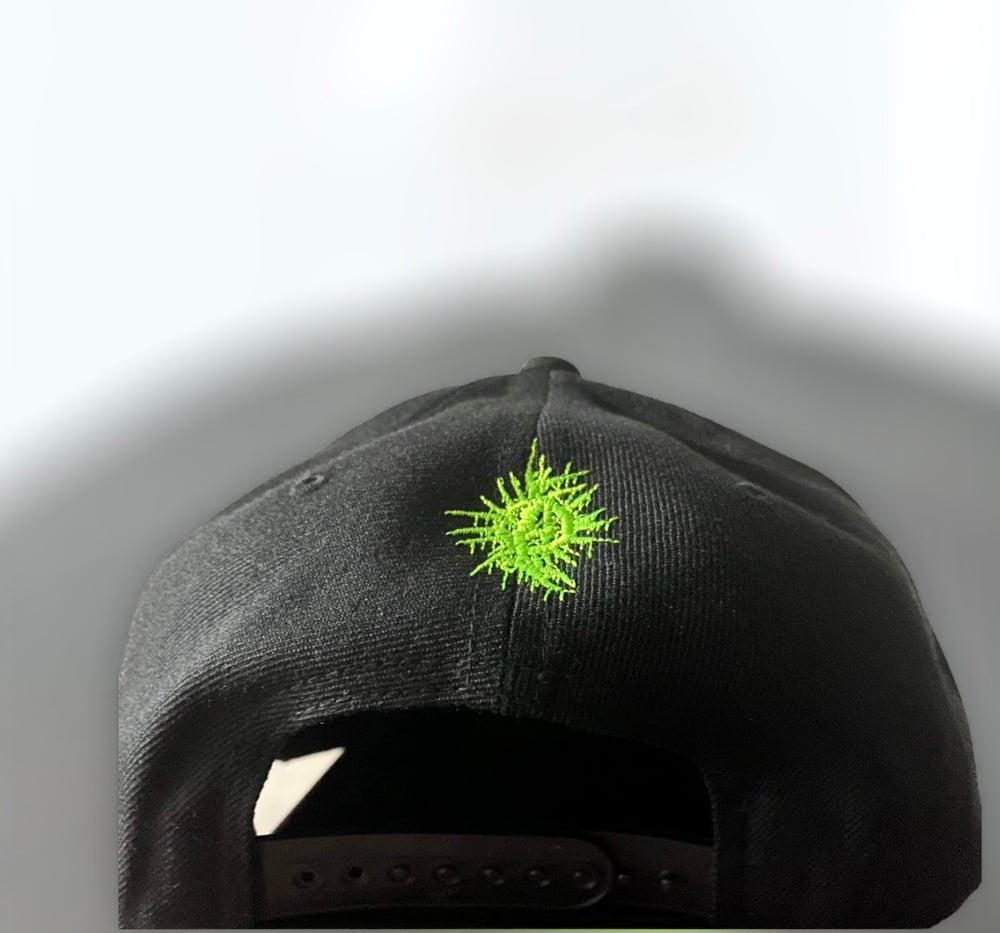 Analepsy (Snapback)